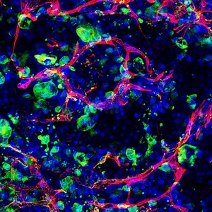 UNC Blood Research Center | UNC Blood Research Center