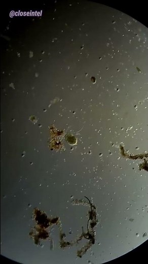 Cell Explodes Under Microscope (Hydrogen Peroxide vs Germs)