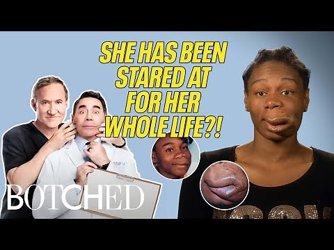 Starrina Was DISCRIMINATED Against for Her Lip Malformation (Before & After) | Botched | E!