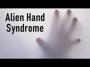 Alien Hand Syndrome