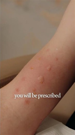 How Allergy Tests Work: A Step-by-Step Overview