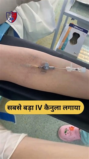 The largest IV cannula was inserted 💉 #cannula #skills #nursing #health #doctor #insert #ambulance