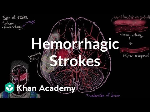 Hemorrhagic strokes | Circulatory System and Disease | NCLEX-RN | Khan Academy