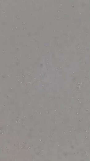 Bacteria Motility in Hanging Drop Preparation Demonstration