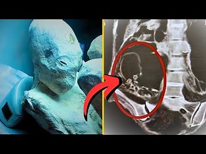 Pregnant ‘Alien Mummy’ Found – Scientists Say It’s 100% Real