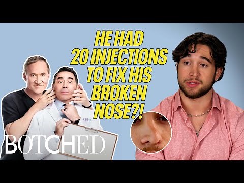 Zaverie IS TERRIFIED To Get Another Nose Job After A Past Operation (Before & After) | Botched | E!