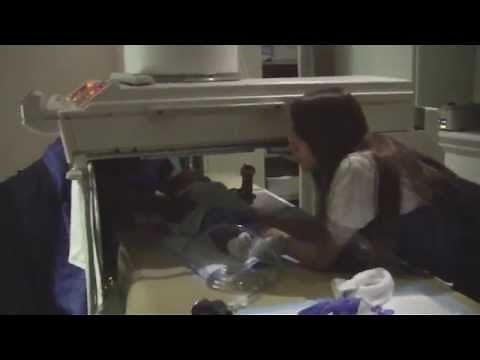 Life Threatening Intussusception Emergency