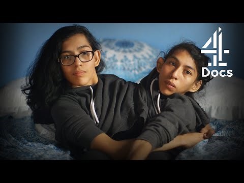 Conjoined Twins on Heartbreaking Difficulty of Being Immigrants in America | Two Sisters, One Body