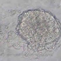 Video: In vitro Differentiation of Mouse Embryonic Stem mES Cells Using the Hanging Drop Method