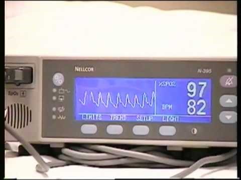 Pulse Oximetry Video
