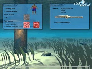 Decompression Sickness (2/2)