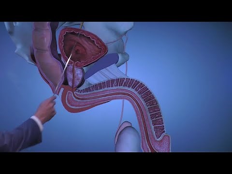 Prostate Anatomy: Overview
