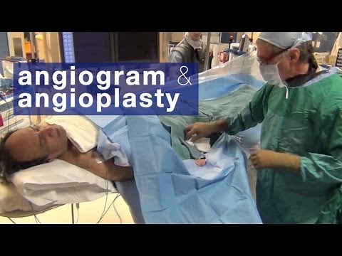 Angiogram & angioplasty: what to expect