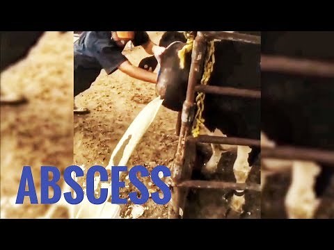 BEST ABSCESS COMPILATION