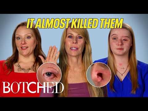 Close Calls With Death: Aggressive Cancer, Infections All Over and More (Compilation) | Botched | E!