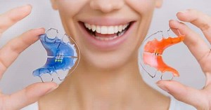 Hawley Retainer Cost, Types and Colours: Your Complete Guide