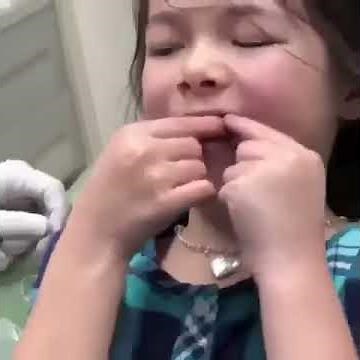 Orthodontic Headgear