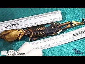 Tiny 'Alien' Skeleton Discovered to Have Human DNA