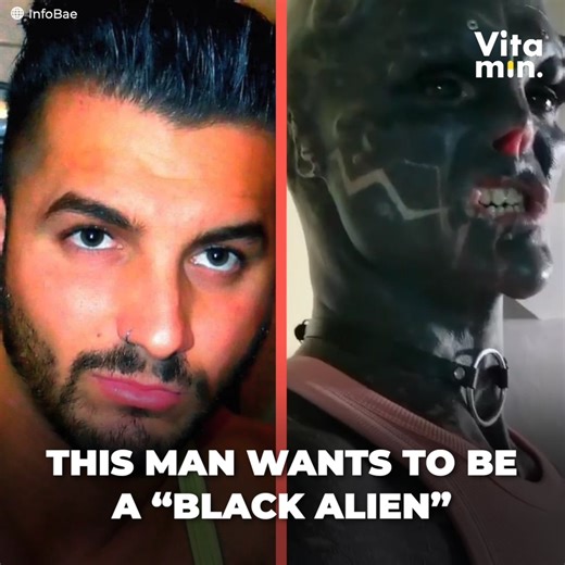 He has no ears and he is missing half his nose. His dream is to look like an alien. And to achieve it, he has been getting surgeries for a decade. This is Anthony Loffredo, the Black Alien. | Vitamin
