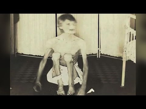 Rare Photos Taken From Old Insane Asylums Show Their Harsh Conditions