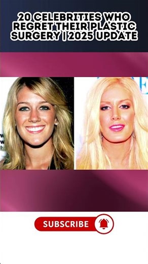 20 Celebrities Who Are Now UNRECOGNIZABLE! | Plastic Surgery Fails 2025 Update Part 1