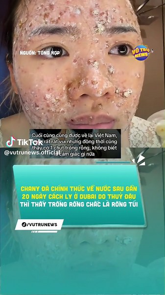 Chany đã chính thức về nước sau gần 20 ngày cách ly ở dubai do thuỷ đậu #vutrunews #chany #dubai #vietnam #tintuc #xahoi