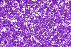 New AI tool can diagnose cancer, guide treatment, predict patient survival— Harvard Gazette