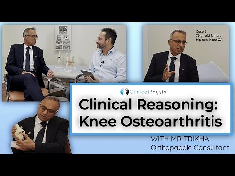 Everything you need to know about Knee Osteoarthritis | Expert Guide with Orthopaedic Surgeon