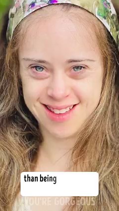 A Model With Down Syndrome Proves You’re the Only One Who Can Define Beauty for Yourself | Bright Side