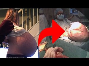 Woman who thought she was pregnant 'gave birth' to a medical alien!