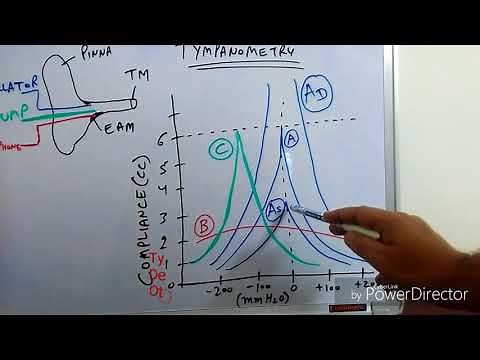 Tympanometry (Impedance Audiometry)