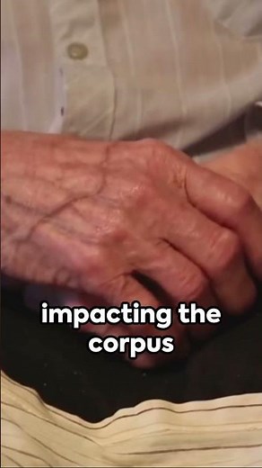 Alien hand syndrome : The Uncontrollable Hand