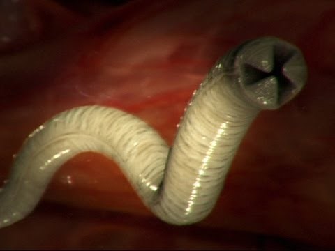 Coughing Up Worms - Monsters Inside Me Ep3