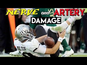 WORST College Football Injury Ever? | Doctor Reviews McKenzie Milton Injury