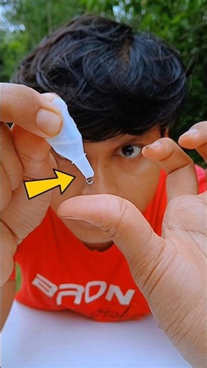 How To Remove Fevi Kwik From Finger? #shorts #ytshorts