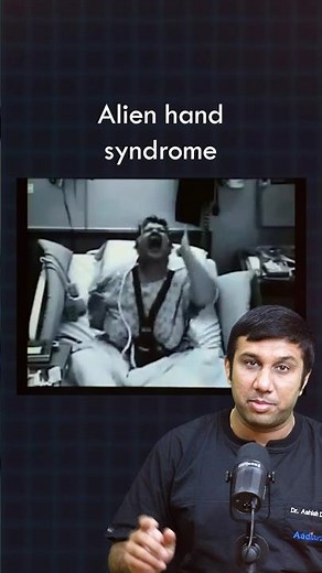 What is an Alien Hand Syndrome?