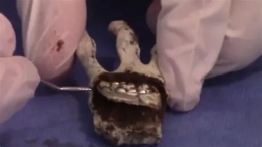 Experts dissect Peru ‘alien mummy’ & make shock discovery beneath flesh