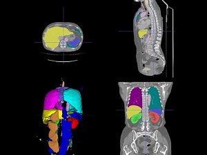Train an Image Segmentation Model in 10 minutes Without Writing any Code