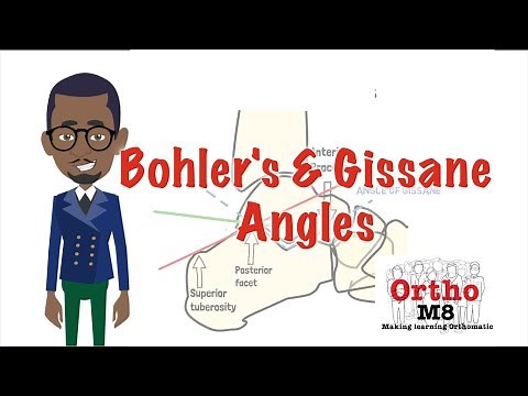 Bohler's and Gissane