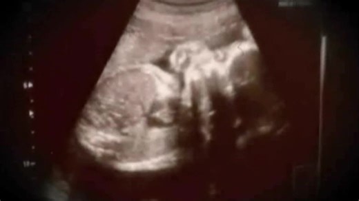 Paraguay man arrested in rape of girl, 10, who became pregnant