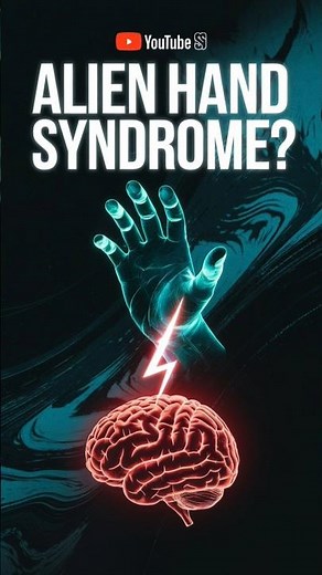 "Alien Hand Syndrome: What Is It? | Mysterious Neurological Condition Revealed"