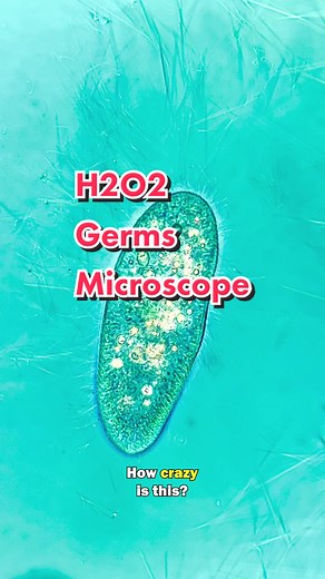 Cell Explosion: Hydrogen Peroxide vs. Germs Under Microscope